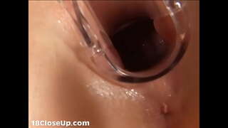 ג ' וליה גינקולוגי בחינה כוס חקר (זמין ב FullHD)